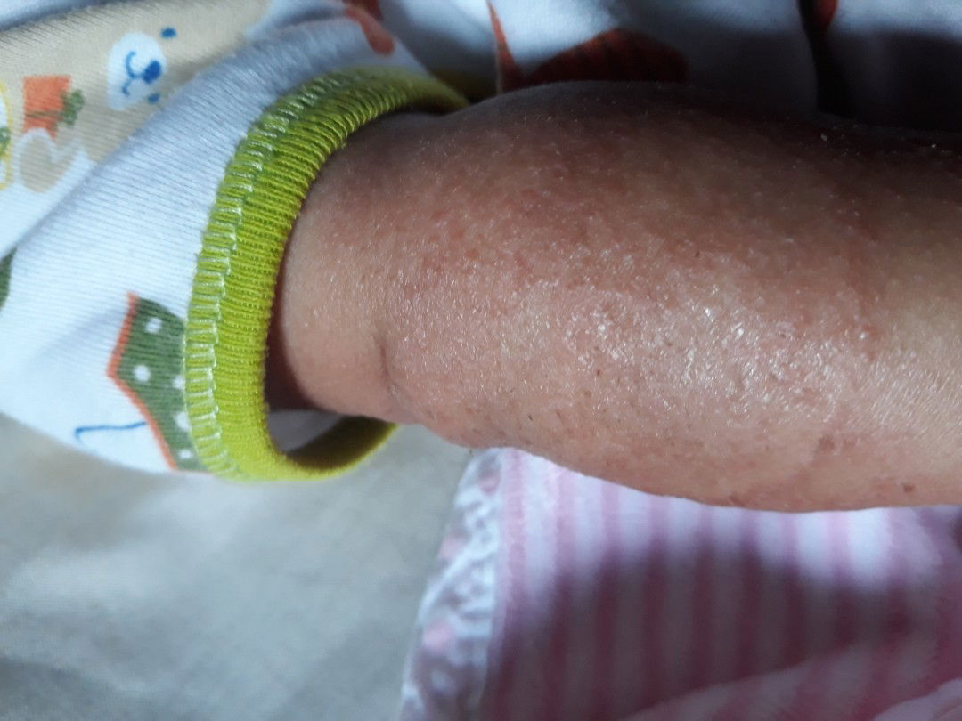 tau obat nya apa bun, tolong dijawab!!