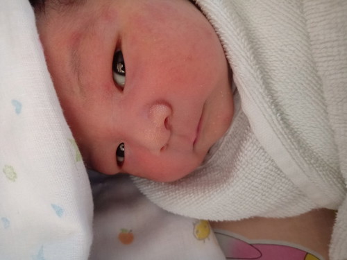 ลูกตัวเหลือง