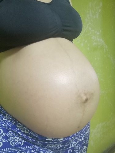 38+2