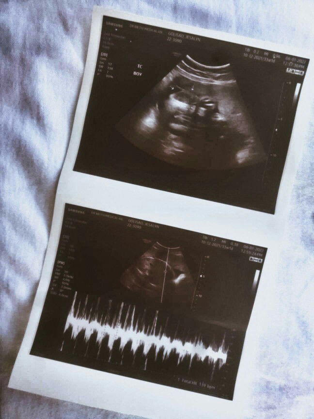 Jezz Sabolo Golisao profile icon