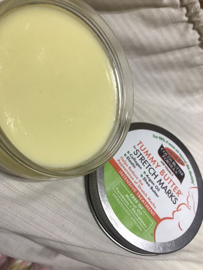 Tummy butter for stretch marks