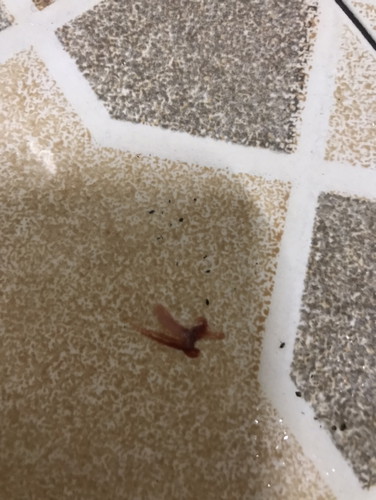 ตั้งครรภ์ได้ 9 สัปดาห์ 4 วัน