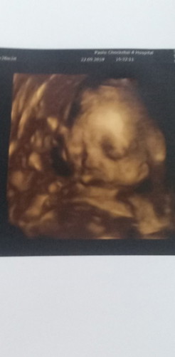 รักแรกพบ