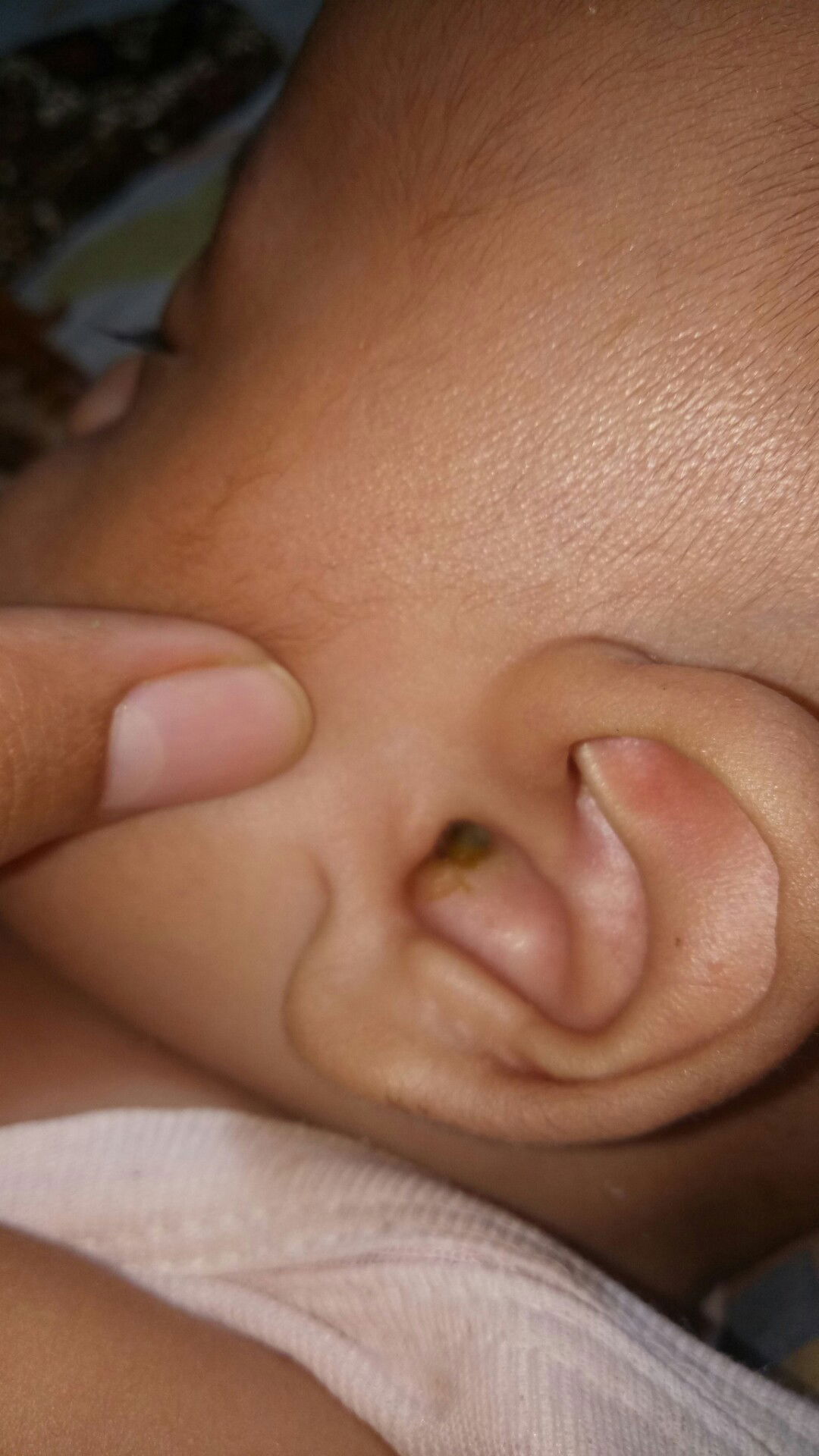 pilek dan keluar lewat kuping (maaf menjijikan)