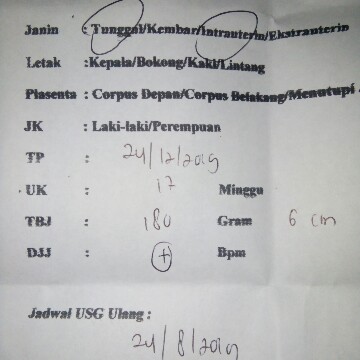 Tinggi badan janin