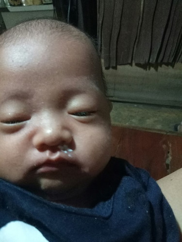 นมออกจมูก