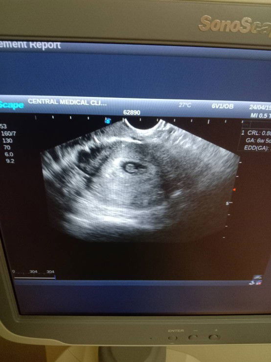 Aunchalee Wry profile icon