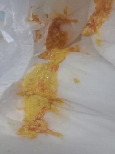 yellow poop. bonamil. FTM