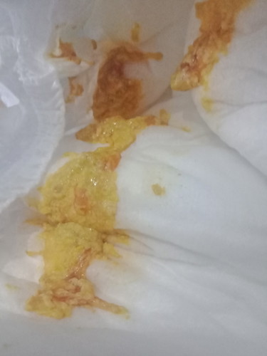 Yellow poop. Bonamil. FTM