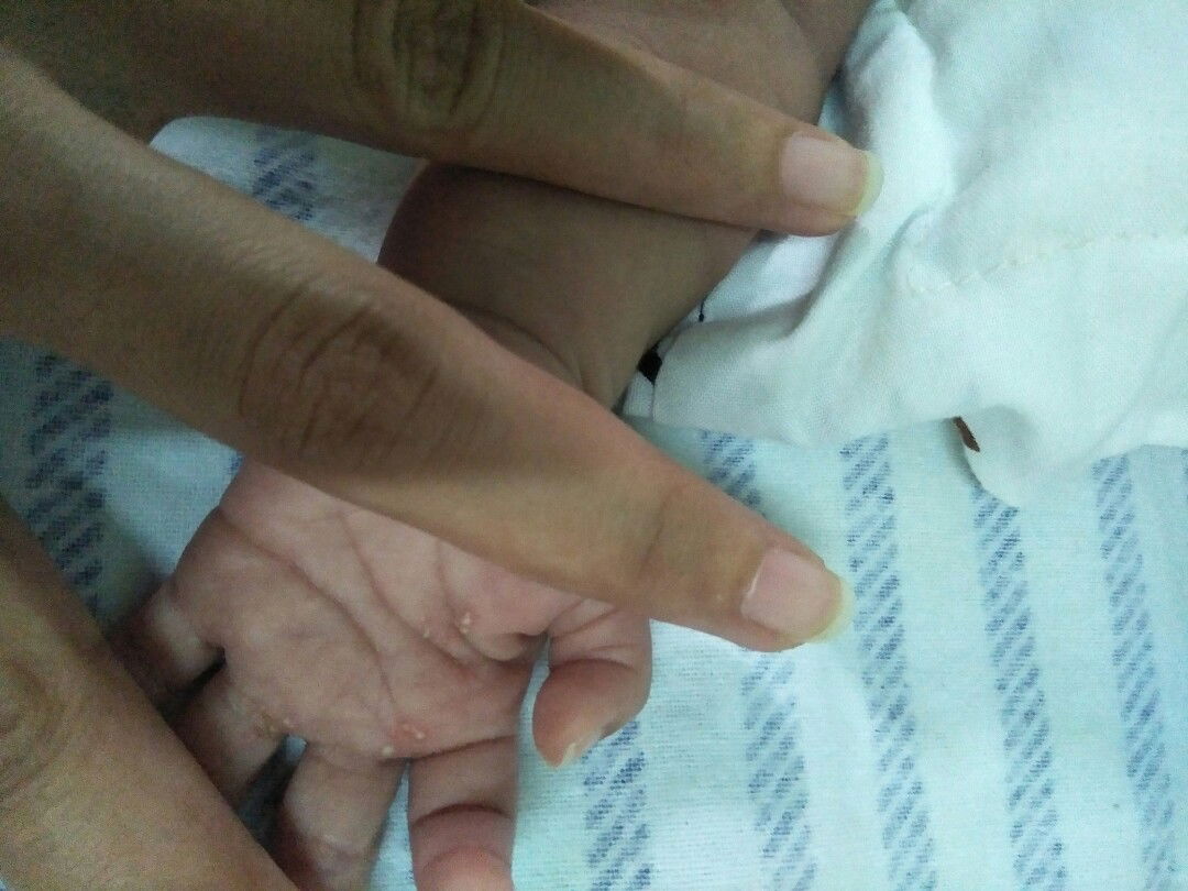 tangan melenting putih putih