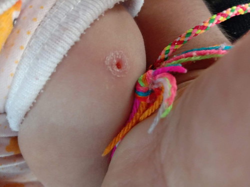 ฉีดวัคซีน