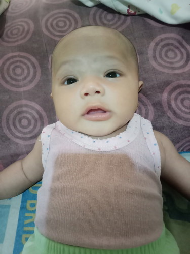 rambut bayi