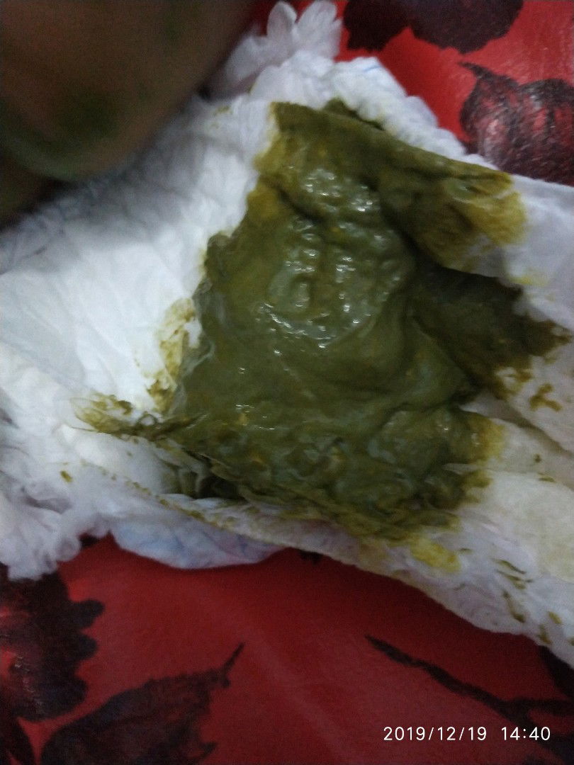 pup berwarna hijau tua