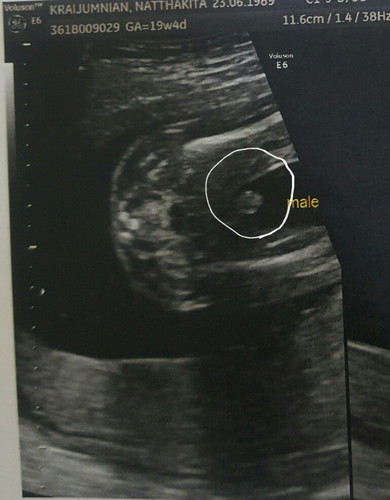 จู๋ มาแล้วคะ ?