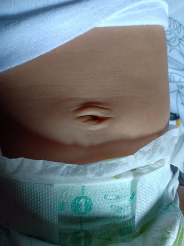 Pusar bayi 2 bulan masih basah