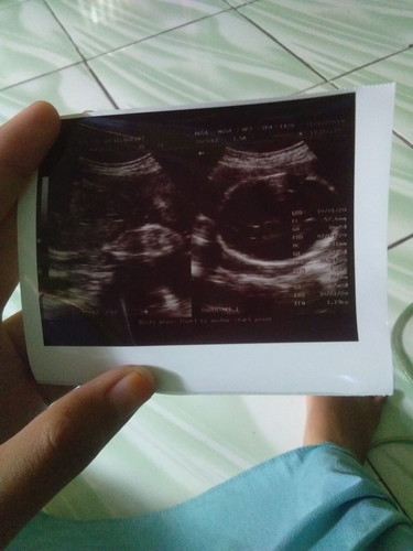 30week