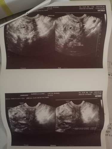 PCOS fighter