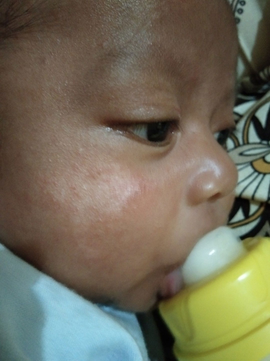 masalah pada wajah bayi