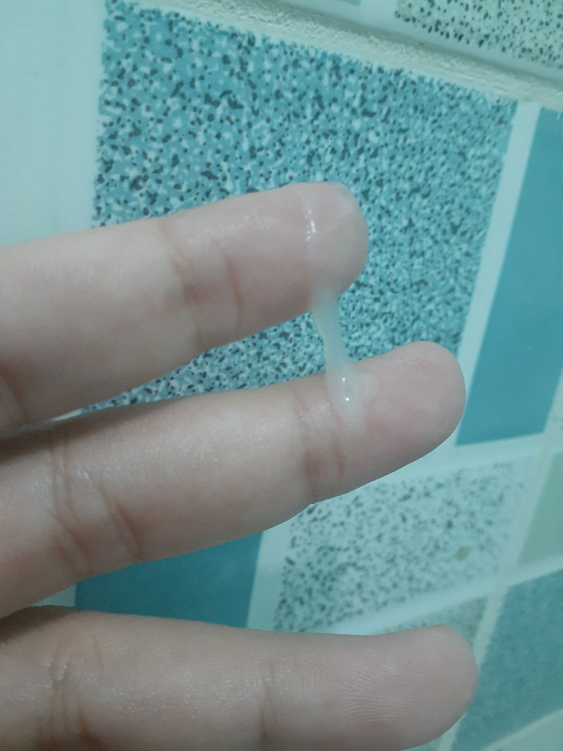 white vaginal discharge