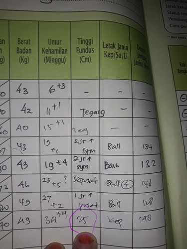 tinggi fundus