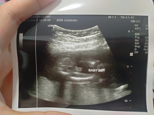 ลูกชายคนแรก