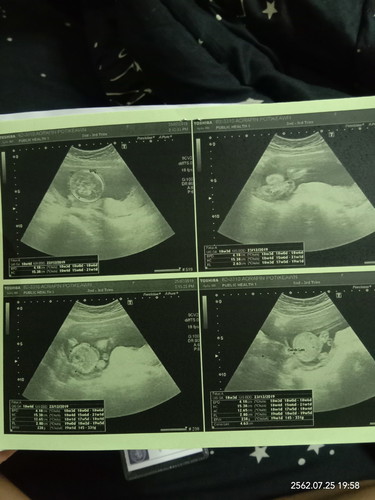 ผู้ชายหรือผู้หญิง