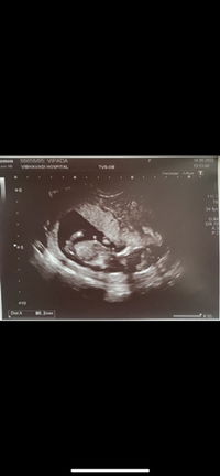 Jb.wiss profile icon