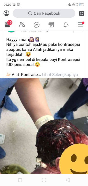 hayo bunda yang pake spiral mana ?