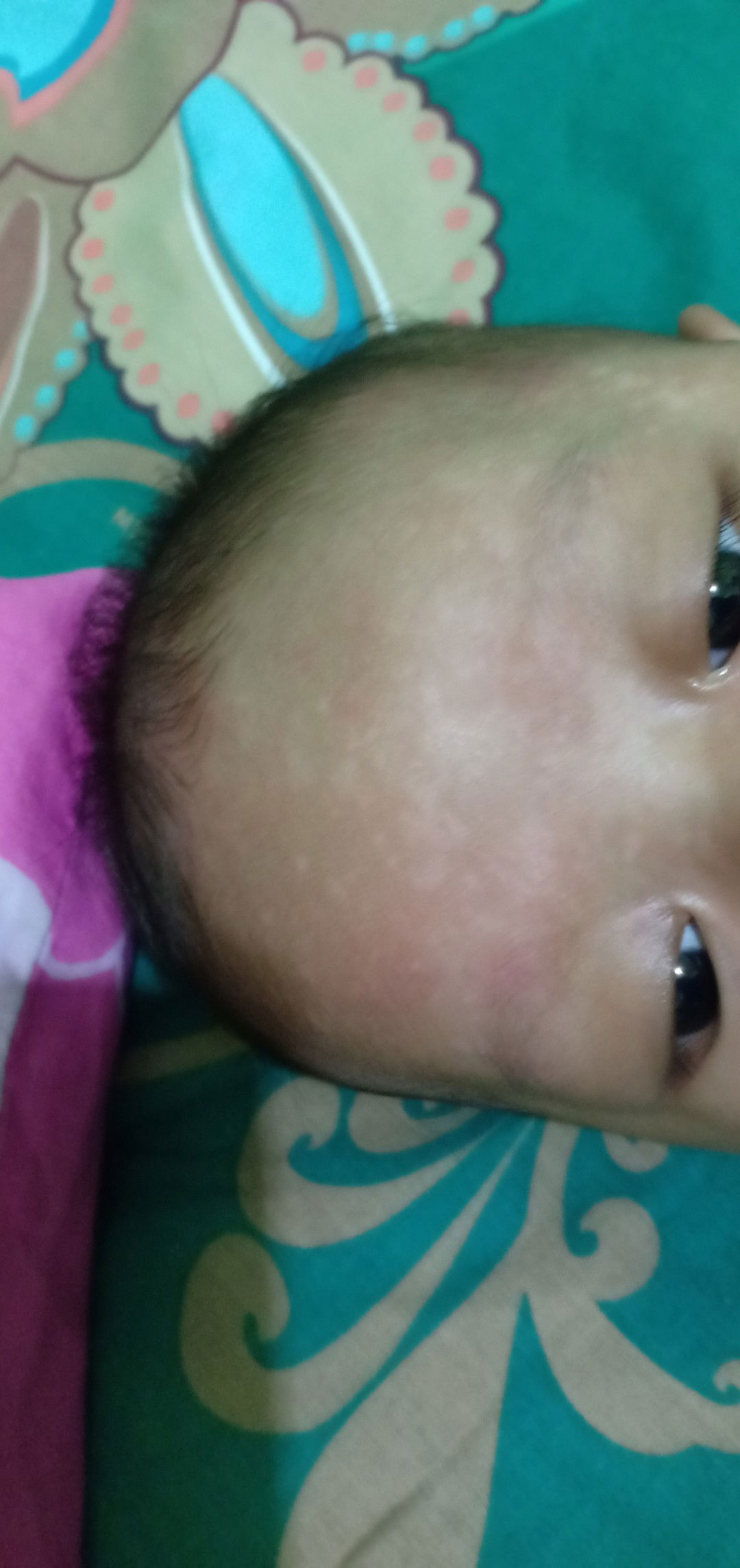 putih2 pada kulit bayi