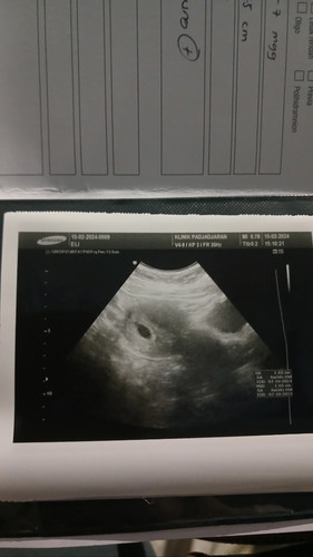 Darah tinggi pada ibu hamil