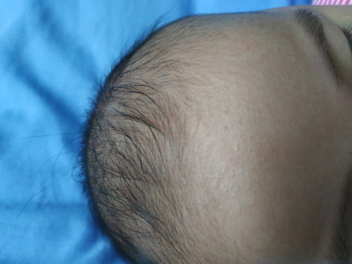 ลูกเป็นผื่นขึ้นตามผิวหนัง