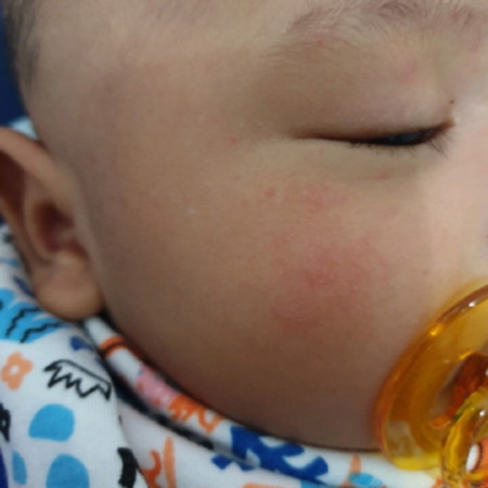 kulit merah
