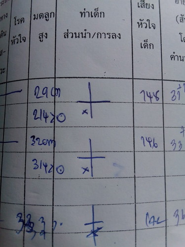 ท่าเด็กส่วนนำ