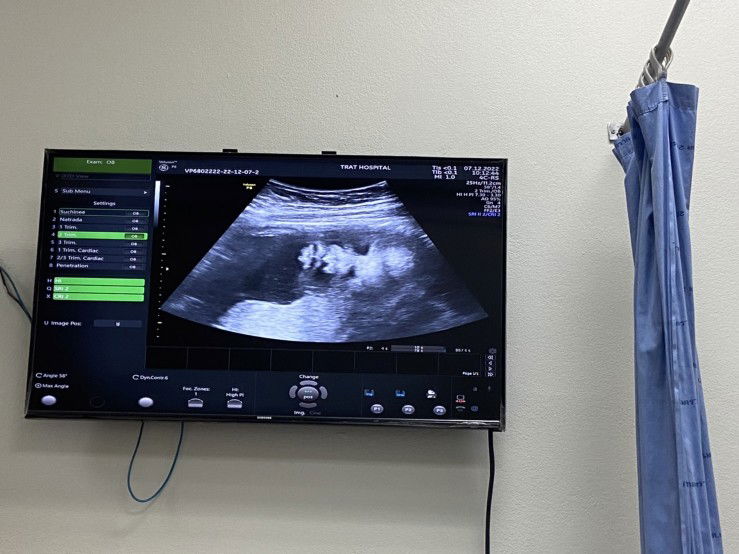 plawhale profile icon