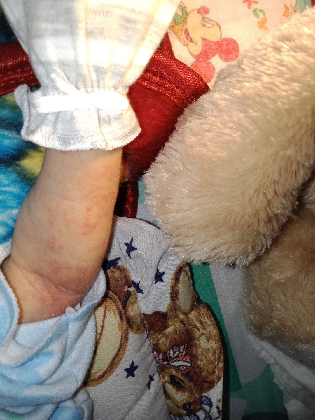 bintik bintik merah dan putih