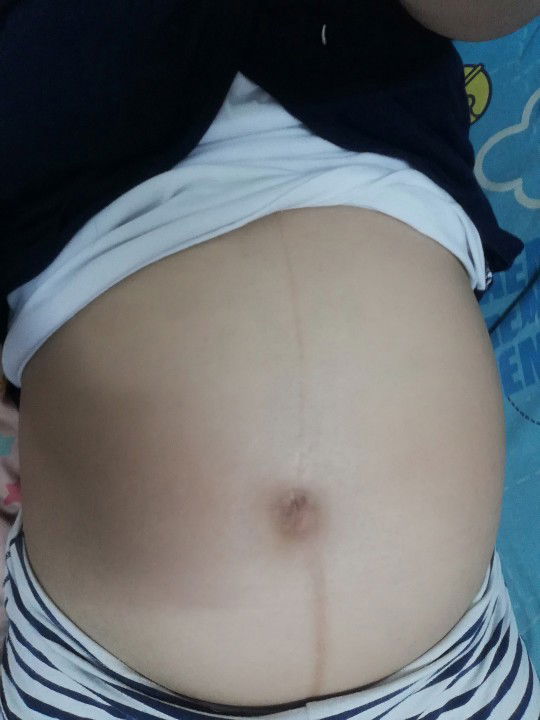 #ร่วมกิจกรรม​#อวดท้อง​คุณ​แม่