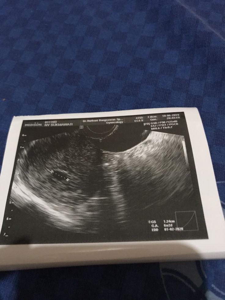 Beda dokter beda diagnosa