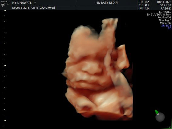 Azzelea Linna profile icon