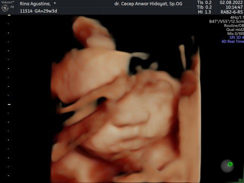 Rina Agustina profile icon