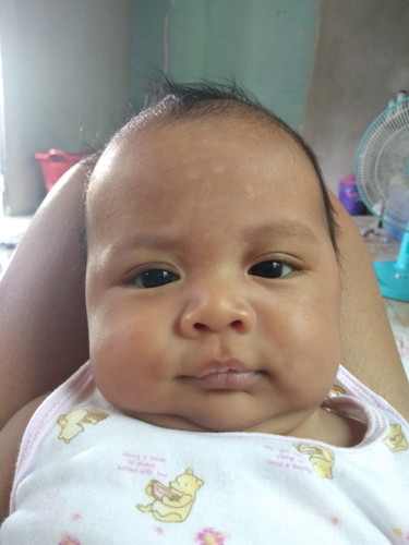 ถามแม่ๆคะจุดด่างขาวหรือกากน้ำนม