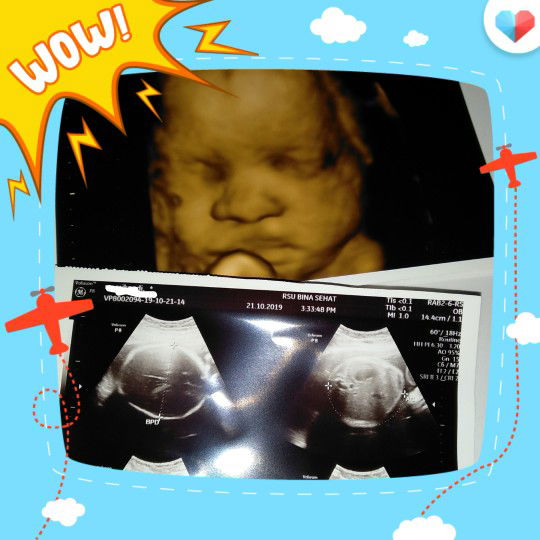 Senangnya liat Dede lewat USG 4D