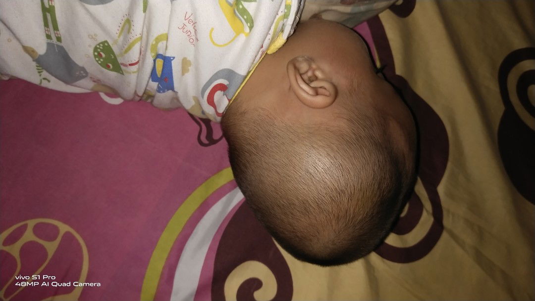 kepala bayi peyang