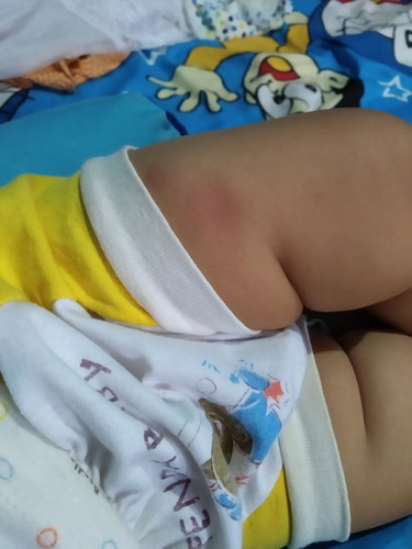 imunisasi dpt