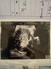 Rika Meldy Agustina profile icon