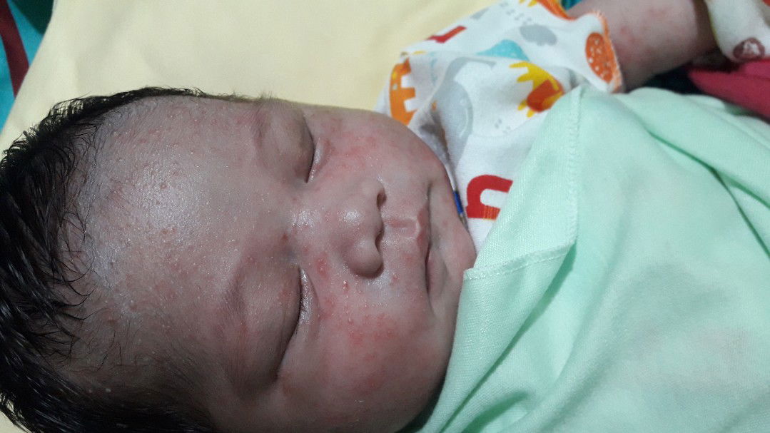 bintik merah dan berair