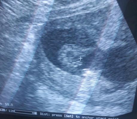 ภาพซาวด์