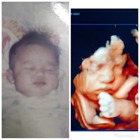 อวดภาพอัลตร้าซาวด์กันหน่อยค้า