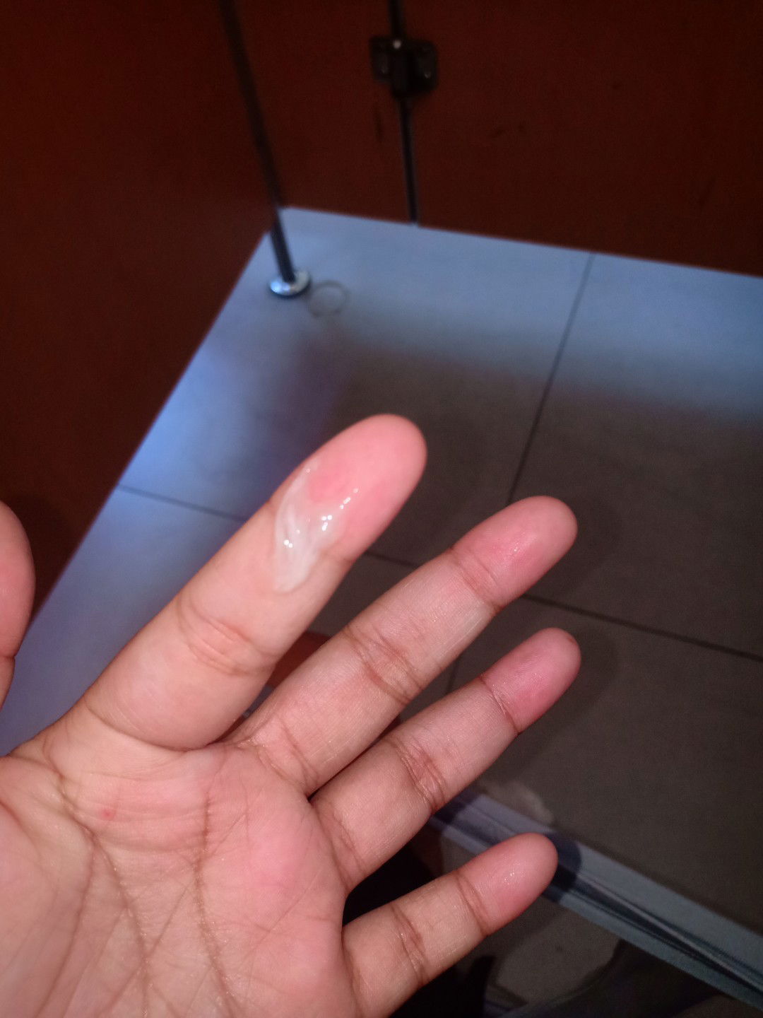 แบบนี้เรียกมูกใสหรือว่าอะไรคะ