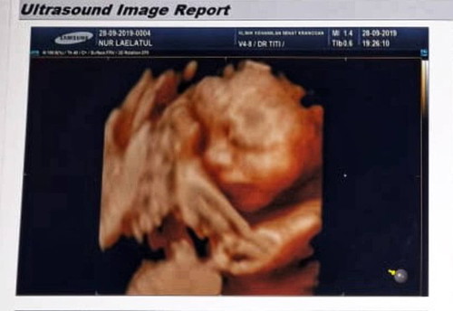 hpl desember akhir tahun baru mana suaranya bund?