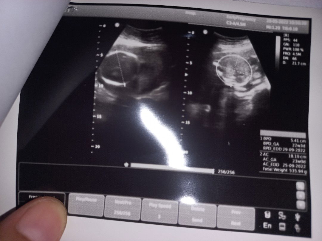 Putri Ainun profile icon